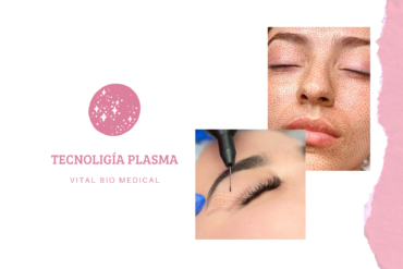 Mesoterapia Capilar con Péptidos